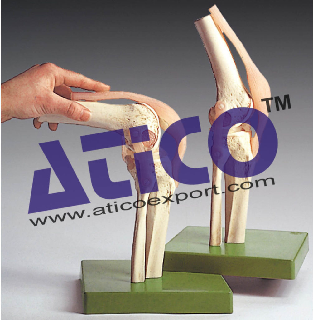Knee Joints Set Manufacturer Supplier India - Atico Export